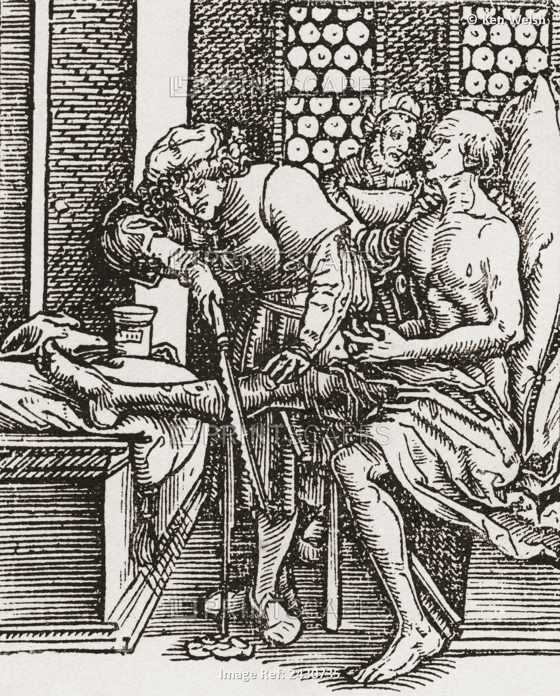 A Physician Performing An Amputation During The Tudor Period In England. From A ...